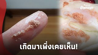 สาวคลื่นไส้ ปอกไข่ต้มกิน เจอเม็ดปริศนาติดมือ ก่อนซูมดูยิ่งสยอง เกิดมาเพิ่งเคยเห็น!update-42-PP