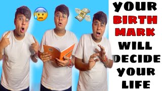 Your Birthmark Will Decide Your Life ~ a moral story #ytshorts #shorts