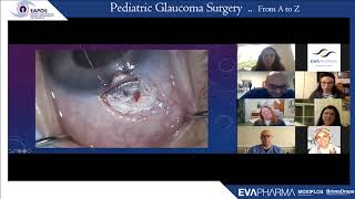 EAPOS Special Pediatric Glaucoma Webinar - Saturday 6 June 2020