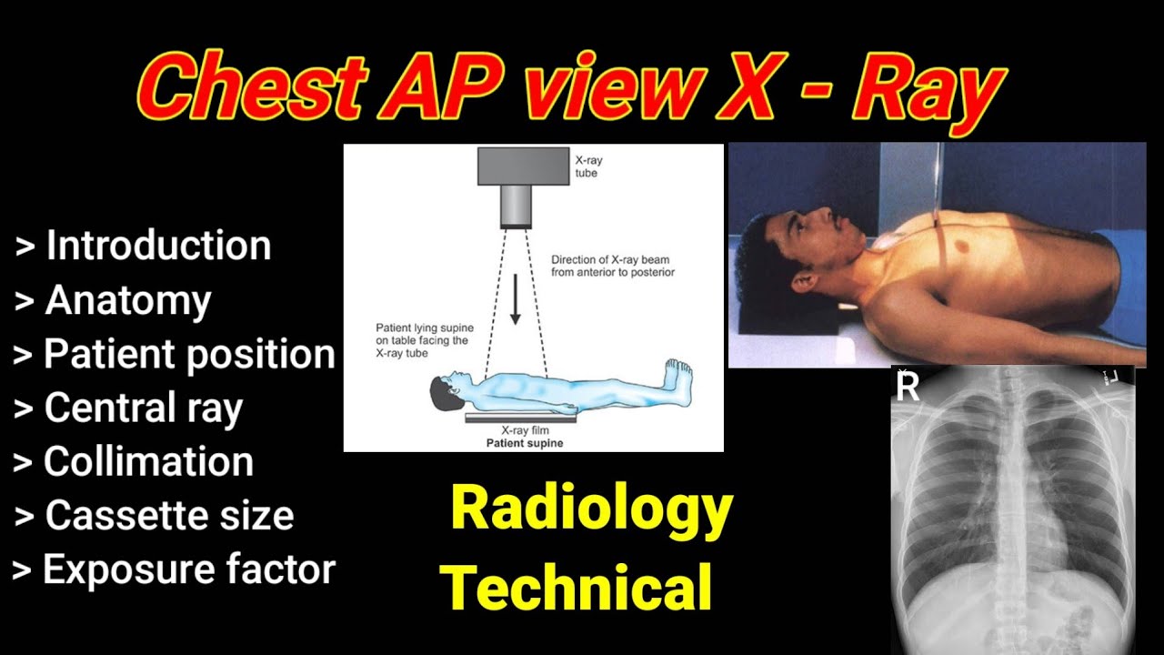 X Ray Positioning Chart X Ray Ekg Chart Dividers Side Tab Lt Yellow