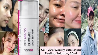 Cosiq ABP 22% Exfoliating Peeling Solution | Honest Review