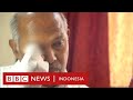 Covid-19 di India: Ancaman kehilangan mata dari infeksi jamur hitam - BBC News Indonesia