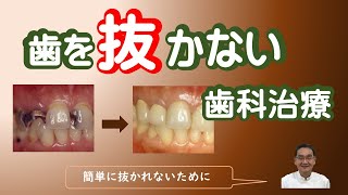 歯を抜かない歯科治療：簡単に抜歯されないために必要なこと