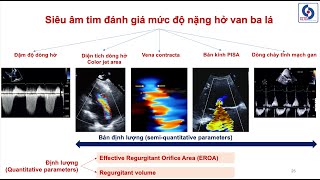 Siêu âm tim đánh giá hở van ba lá (Phần 2: đánh giá mức độ nặng)