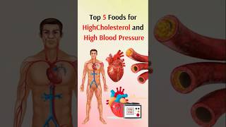 Top 5 Foods for Cholesterol and High Blood Pressure.