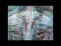 Cerebellopontine Angle and Fourth Ventricle (3D) - Part 1 of 2