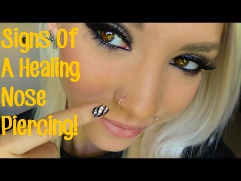 Signs of a Healing Nose Piercing. Signs of a Healing Nose Piercing.