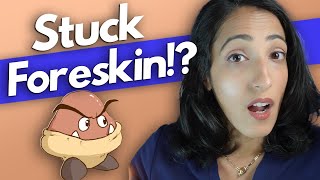 Foreskin that won't pull back?! Phimosis Causes & Treatments