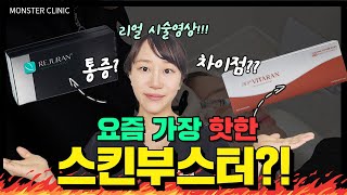 얼굴전체 비타란 많이 할수록 과연 좋을까? 리쥬란이랑 완벽비교, 리얼 시술 🇯🇵日本語字幕/🇨🇳中国語字幕