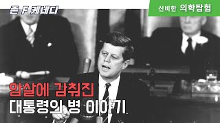 암살에 감춰진 케네디 대통령의 병 이야기 (feat 케네디, 미스터리, 애디슨병, 척추수술)