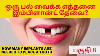 ஒரு பல் வைக்க எத்தனை இம்பிளான்ட் தேவை? | how many implant needed to replace a missing tooth | Dr.MKP