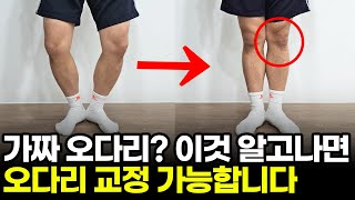 오다리 교정운동 하려면 '이것' 부터 확인하셔야 합니다