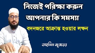 বদনজরে আক্রান্ত হওয়ার লক্ষন।নিজেই পরিক্ষা করুন আপনার কি সমস্যা। জিন যাদুর চিকিৎসা। তাহসিন জুবায়ের