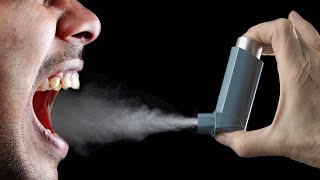 Strange ORAL LESIONS After Decades of INHALER Use