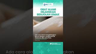 Tips Menghilangkan Lipoma dengan Alami Tanpa Obat, Termasuk Teh Hijau hingga Lidah Buaya