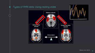 Introduction to fMRI data analysis in Python (Basic)