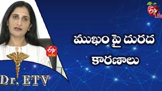 Causes of Dermatitis | ముఖం పై దురద - కారణాలు | Dr.ETV | 6th December 2021| ETV Life