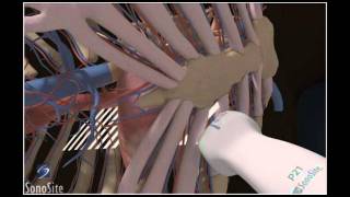 How To: Parasternal Long Axis View, Echocardiography 3D Video