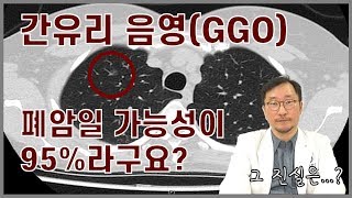 [흉부학개론] GGO, 간유리음영이 폐암 초기의 형태? 강남 세브란스 병원 이성수과장님이 얘기하는 그 진실은?