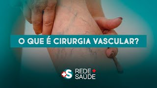 O QUE É A ANGIOLOGIA (CIRURGIA VASCULA) ?