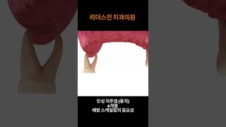 [리더스진 치과의원] 6개월 예방 스케일링을 하지 않으면 발생하는 일ㅣ회복 불가한 치아의 탈락 유발 ㅣ만성치주염