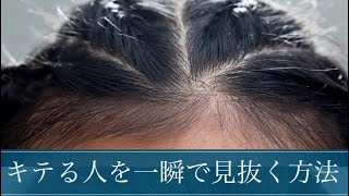 薄毛かどうかを一瞬で見抜く方法