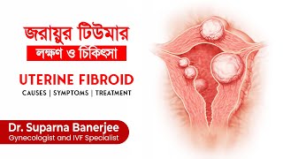 জরায়ুর টিউমারের লক্ষণ ও চিকিৎসা  | Uterine fibroid - causes, symptoms, diagnosis \u0026 modern treatment