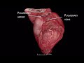 Human Organ Atlas: HiP-CT imaging of a human heart using the ESRF-EBS (2)