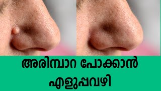 അരിമ്പാറ പോക്കാൻ ഏറ്റവും എളുപ്പവഴി | How To Remove Warts Easily, Healthy Kerala