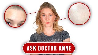 The different types of hyperpigmentation | Ask Doctor Anne