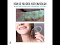 How do you Deal with Invisalign and 3rd molars/ Wisdom Teeth?