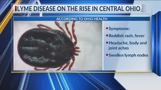 NBC4 Chief Meteorologist Dave Mazza shares personal experience with Lyme disease to raise awareness