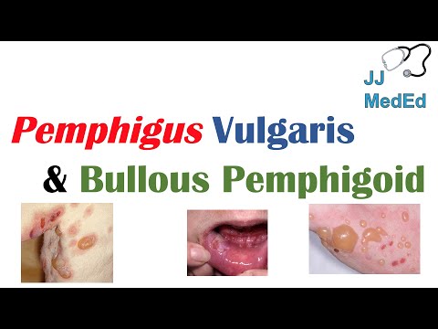 Does bullous pemphigoid occur in mouth?