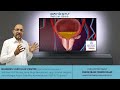 પ્રોસ્ટેટ ની સારવાર કરાવો અધ્યતન ટેકનિક prostatic artery embolization થી.