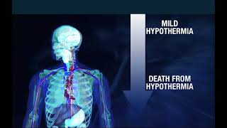 Cold Weather Emergencies VIDEO
