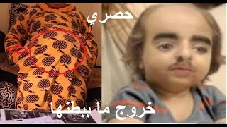 حصري... تطورات في قصة المرأة الحامل منذ 9 سنوات   خروج ما ببطنها