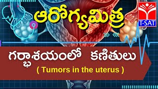 T-SAT || ఆరోగ్యమిత్ర : గర్భాశయం లో  కణితులు  || Dr. Hema Reddy