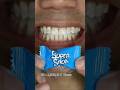 Super Soda Candy Satisfying ASMR #DoctorTristanPeh #SuperSoda