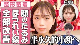 【切開リフトでたるみ改善】 小顔で若返るA式美肌たるみ切開の施術に密着！