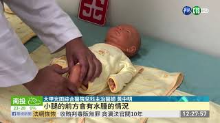 「腎病症候群」好發2-6歲 嚴重恐致死 | 華視新聞 20191114