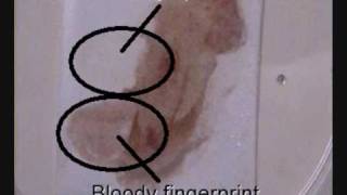 Bloody fingerprints