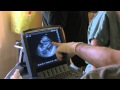 A Good Amount of Art - Sonosite Ultrasound