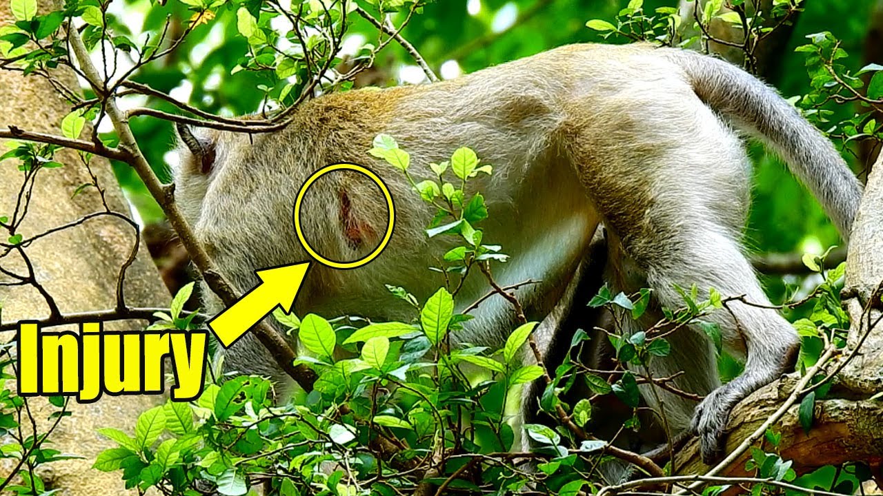 Painful And Hurt! Poor Sankra Still Hurt That Why He Often Makes Ba-d Att-itude To Others.