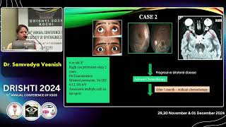 KSOS2024 Dr Samvedya Veenish U O FP97   Clinical profile and management outcomes in children w