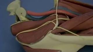 Ilioinguinal Approach to Acetabulum fracture Fixation