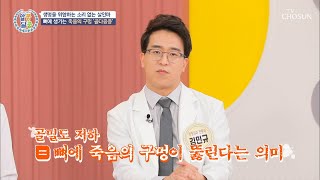 암보다 높은 사망률(⊙_⊙;) 침묵의 질환 『골다공증』 TV CHOSUN 20220609 방송 | [알콩달콩] 136회 | TV조선