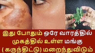 மங்கு மறைய |  முகத்தில் உள்ள மங்கு விரட்டியடிக்க | GET RID FROM DARK PIGMENTATION