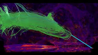 FiberNavigator tutorial: Drawing tool