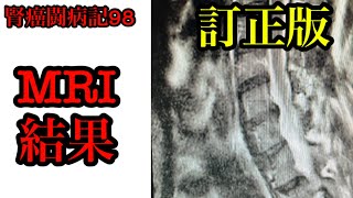 訂正版 がん患者のMRI結果 (肩の痛み、手の痺れ）　#がんステージ4 #ガン再発