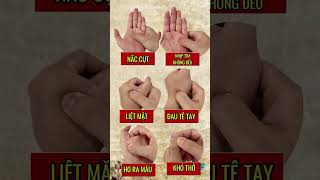 Top 6 huyệt trên bàn tay giúp nâng cao sức khoẻ - Thực hiện cùng Triều Đông Y